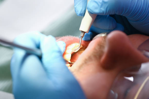 Best Emergency Tooth Extraction in St George, MO